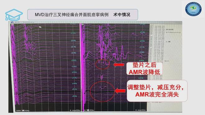 Ժ20حʹ漡ε­񾭼(ͼ1)